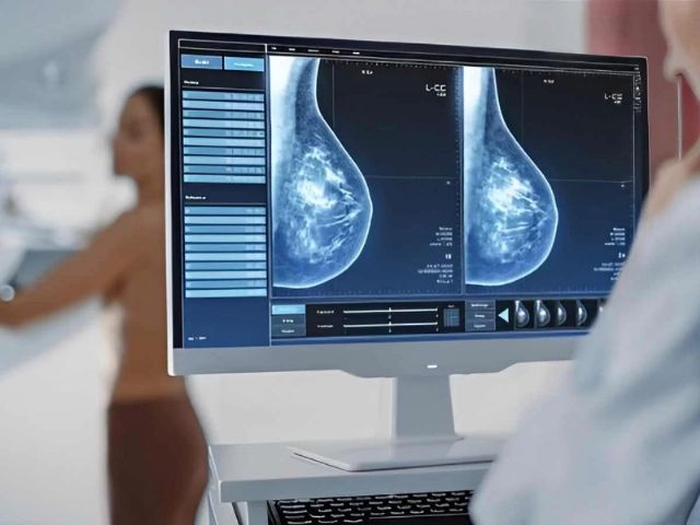 El Ayuntamiento pide a la consejería de Salud que garantice las mamografías en Alhama, tras dejar de prestar este servicio la AECC