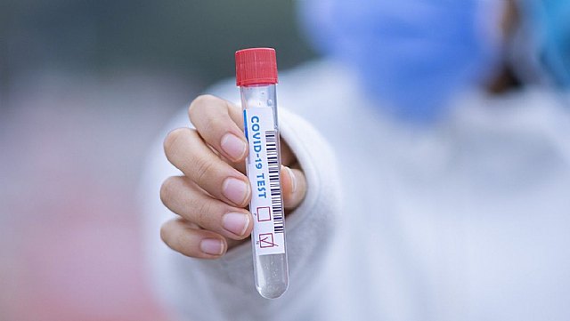 Los rebrotes de Covid-19 obligan a tomar nuevas medidas para evitar que la expansión del virus se descontrole